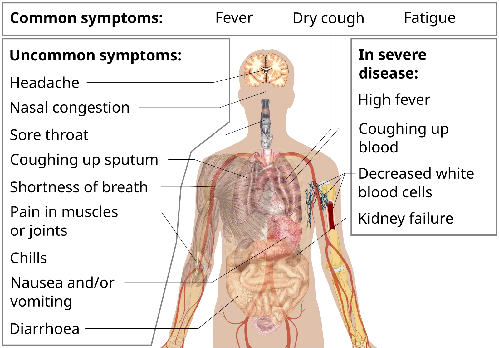Early COVID symptoms in 2025